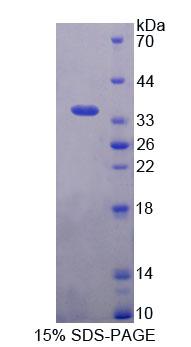 Recombinant Bcl2 Associated Athanogene 4 (BAG4)
