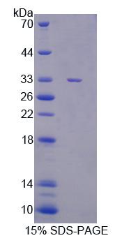 Recombinant Cancer Susceptibility Candidate 5 (CASC5)