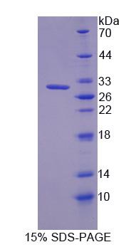 Recombinant Tight Junction Protein 3 (TJP3)