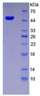 Recombinant Centrosomal Protein 57kDa (CEP57)