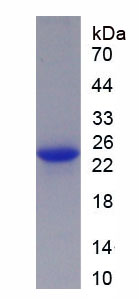 Recombinant Centrosomal Protein 57kDa (CEP57)