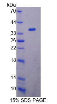 Recombinant Carboxypeptidase N2 (CPN2)