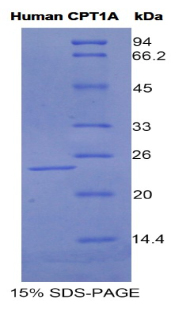 Recombinant Carnitine Palmitoyltransferase 1A, Liver (CPT1A)