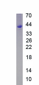 Recombinant Kelch Domain Containing Protein 1 (KLHDC1)
