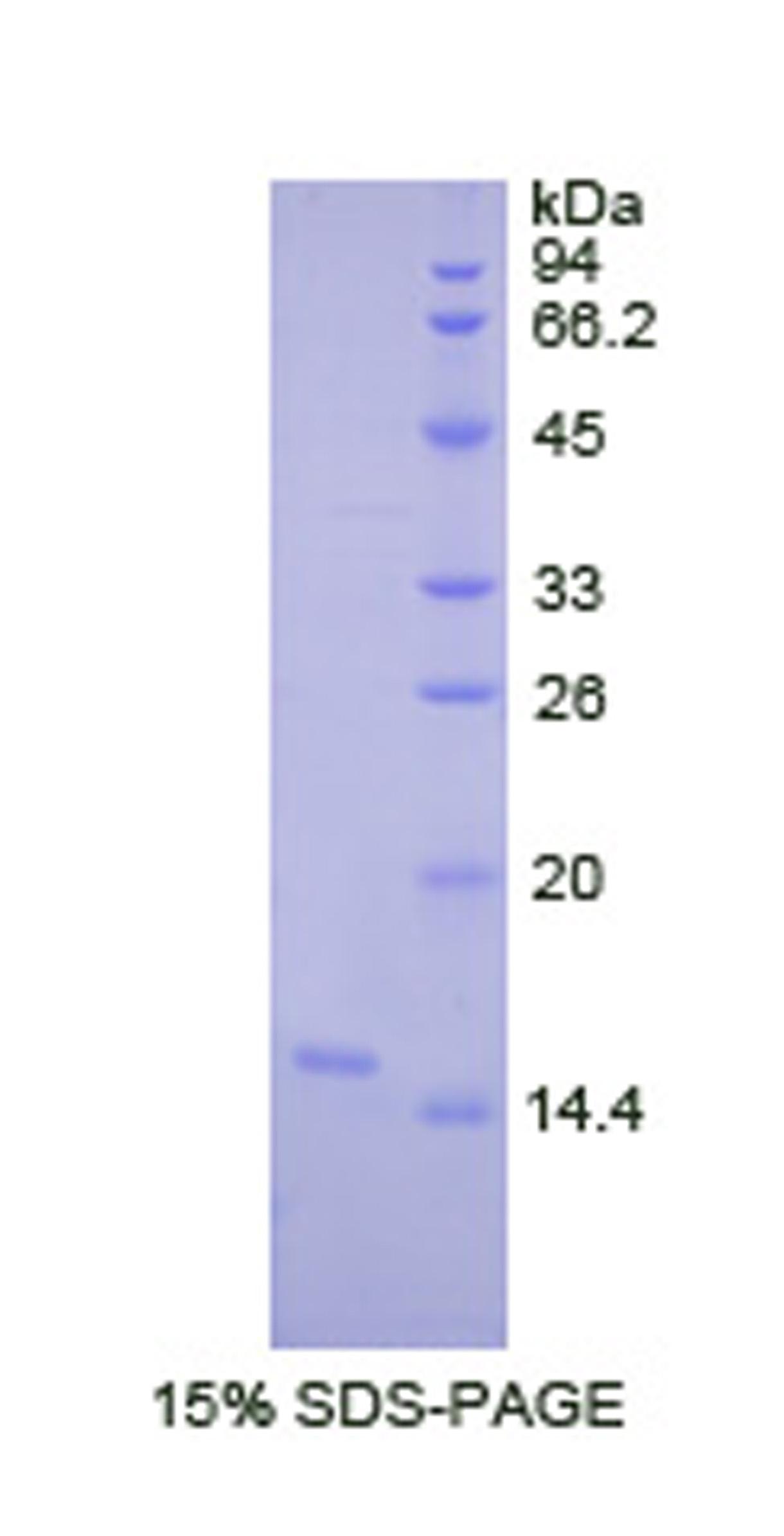 Recombinant Lysyl Oxidase Like Protein 2 (LOXL2)