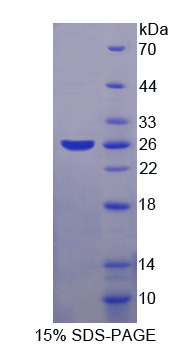 Recombinant S-Phase Kinase Associated Protein 1 (SKP1)