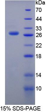 Recombinant Sclerostin Domain Containing Protein 1 (SOSTDC1)