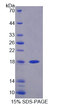 Recombinant Dual Specificity Phosphatase 5 (DUSP5)