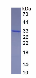 Recombinant Forkhead Box Protein F2 (FOXF2)