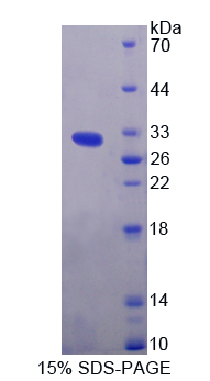 Recombinant Protein Kinase, AMP Activated Beta 2 (PRKAb2)
