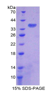 Recombinant ATPase, H+ Transporting, Lysosomal Accessory Protein 2 (ATP6AP2)