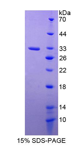 Recombinant Palmitoyl Protein Thioesterase 1 (PPT1)