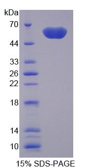 Recombinant Triggering Receptor Expressed On Myeloid Cells 2 (TREM2)