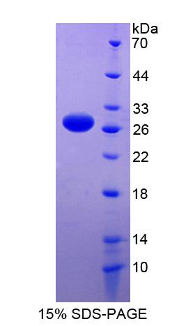 Recombinant RNA Binding Motif Protein 38 (RBM38)