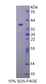 Recombinant Crk Like Protein (CRKL)