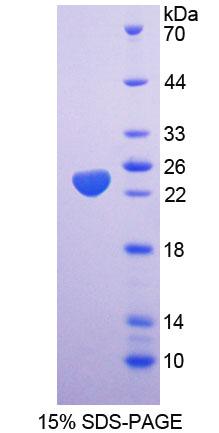Recombinant Spermidine/Spermine N1-Acetyltransferase 1 (SAT1)