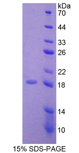 Recombinant WNT1 Inducible Signaling Pathway Protein 1 (WISP1)