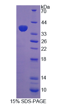 Recombinant Signal Transducing Adaptor Protein 1 (STAP1)