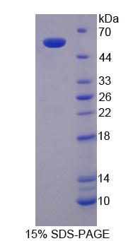 Recombinant Serine Palmitoyltransferase, Long Chain Base Subunit 3 (SPTLC3)