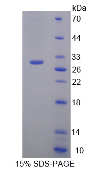 Recombinant Plexin B1 (PLXNB1)