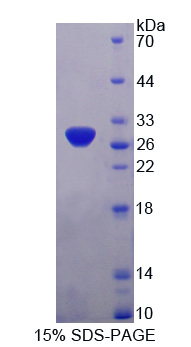 Recombinant Pyruvate Dehydrogenase Complex Component X (PDHX)