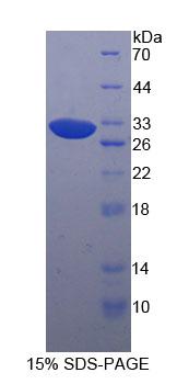Recombinant p21 Protein Activated Kinase 4 (PAK4)