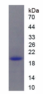 Recombinant p21 Protein Activated Kinase 4 (PAK4)