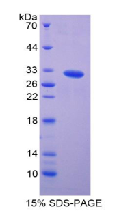 Recombinant p21 Protein Activated Kinase 2 (PAK2)