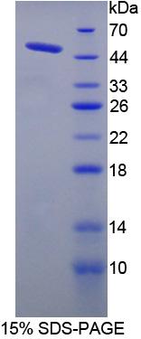 Recombinant Mannose Phosphate Isomerase (MPI)