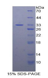Recombinant N-Methylpurine DNA Glycosylase (MPG)