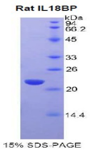 Recombinant Interleukin 18 Binding Protein (IL18BP)