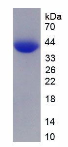 Recombinant T-Box Protein 3 (TBX3)
