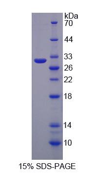 Recombinant Glycoprotein A33 (GPA33)