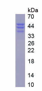 Recombinant DNA Methyltransferase 3B (DNMT3B)