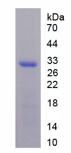 Recombinant Cartilage Intermediate Layer Protein 2 (CILP2)