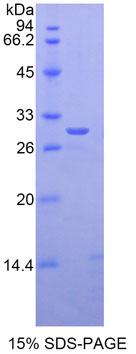 Recombinant GLI Family Zinc Finger Protein 3 (GLI3)
