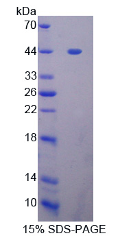 Recombinant GLI Family Zinc Finger Protein 1 (GLI1)