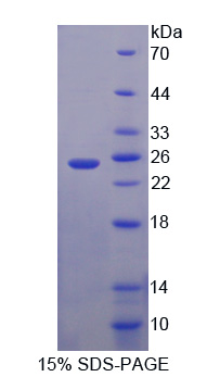 Recombinant Cbp/p300 Interacting Transactivator, With Glu/Asp Rich Carboxy Terminal Domain 1 (CITED1)