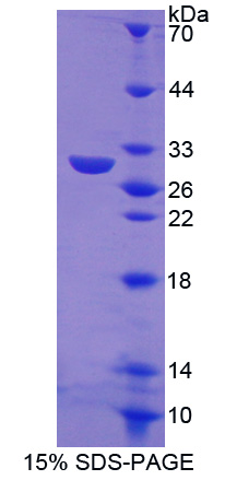 Recombinant TRAF Family Member Associated NFKB Activator (TANK)
