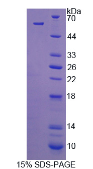 Recombinant C1q And Tumor Necrosis Factor Related Protein 1 (C1QTNF1)