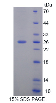 Recombinant Family With Sequence Similarity 3, Member D (FAM3D)