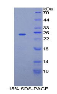 Recombinant Sprouty Homolog 2 (SPRY2)