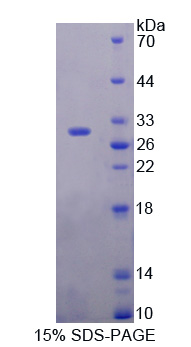 Recombinant DIX Domain Containing Protein 1 (DIXDC1)