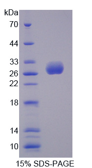 Recombinant UL16 Binding Brotein 2 (ULBP2)