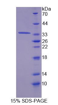 Recombinant Nuclear Factor, Erythroid Derived 2 Like Protein 2 (NFE2L2)