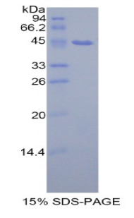 Recombinant Prolactin Induced Protein (PIP)