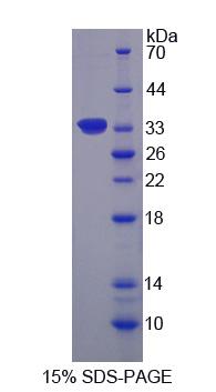 Recombinant Ribosomal Protein S6 Kinase Alpha 1 (RPS6Ka1)