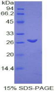 Recombinant Transmembrane Protein 173 (TME<b>M173</b>)