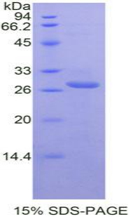 Recombinant T-Cell Immunoreceptor With Ig And ITIM Domains Protein (TIGIT)