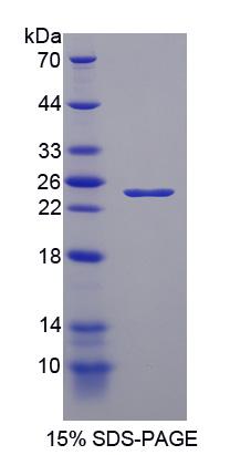 Recombinant Nei Endonuclease VIII Like Protein 3 (NEIL3)